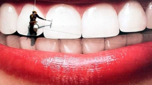 stomatoloska-ordinacija-vunjak-tim-izbeljivanje-zuba-2